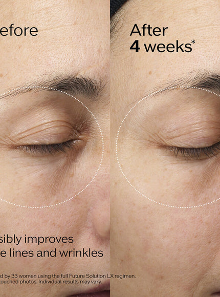 Shiseido Future Solution LX Eye and Lip Contour Regenerating Cream